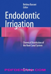 Endodontic Irrigation Chemical disinfection of the root canal system (pdf)